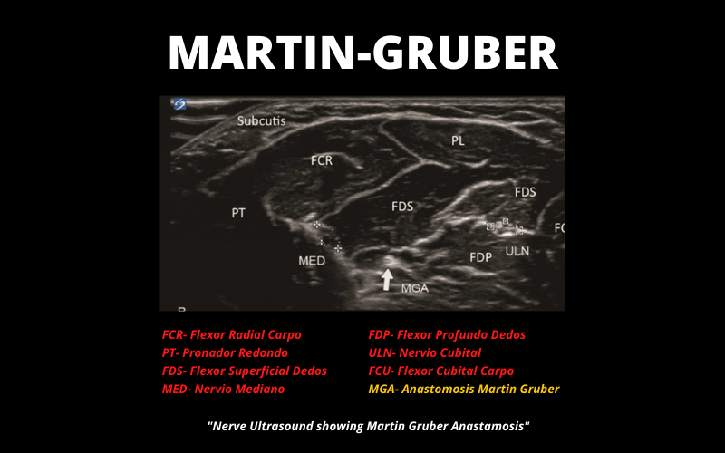 Martin - Gruber.png